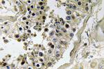 INHBC Antibody in Immunohistochemistry (Paraffin) (IHC (P))