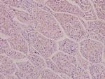 NMDAR2D Polyclonal Antibody