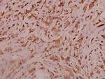 Sodium Channel Pan Polyclonal Antibody