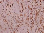 SCN2A Polyclonal Antibody