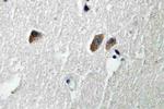 CaMKII beta/gamma/delta Polyclonal Antibody