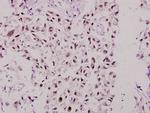 MSK1 Polyclonal Antibody