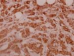 RPS11 Antibody in Immunohistochemistry (Paraffin) (IHC (P))