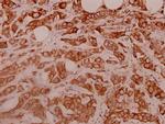 RPS11 Antibody in Immunohistochemistry (Paraffin) (IHC (P))