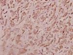 RPL7 Antibody in Immunohistochemistry (Paraffin) (IHC (P))