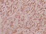 RPL7 Polyclonal Antibody