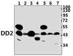 AKR1C2 Polyclonal Antibody