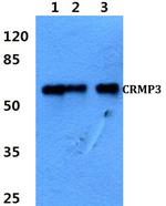 CRMP3 Antibody in Western Blot (WB)