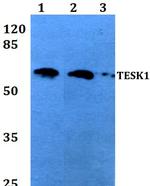 TESK1 Polyclonal Antibody
