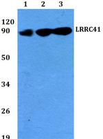 LRRC41 Polyclonal Antibody
