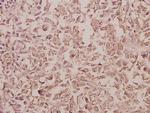RAB5C Antibody in Immunohistochemistry (Paraffin) (IHC (P))