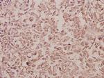 RAB5C Polyclonal Antibody