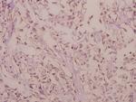RhoG Polyclonal Antibody