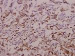 OATP1 Polyclonal Antibody