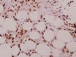 SFRS15 Antibody in Immunohistochemistry (Paraffin) (IHC (P))