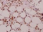 SFRS15 Polyclonal Antibody