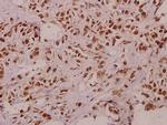 TCEAL1 Antibody in Immunohistochemistry (Paraffin) (IHC (P))