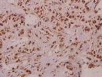TCEAL1 Polyclonal Antibody