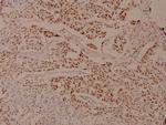 Phospho-Androgen Receptor (Ser650) Polyclonal Antibody