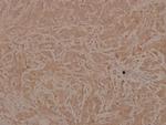 Phospho-ASK1 (Ser83) Antibody in Immunohistochemistry (Paraffin) (IHC (P))