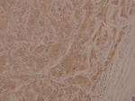 Phospho-ASK1 (Ser966) Antibody in Immunohistochemistry (Paraffin) (IHC (P))