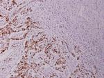 Phospho-Bcl-2 (Thr56) Antibody in Immunohistochemistry (Paraffin) (IHC (P))