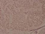 Phospho-BRCA1 (Ser1524) Polyclonal Antibody