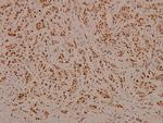 Phospho-C/EBP beta (Thr188, Thr235) Polyclonal Antibody