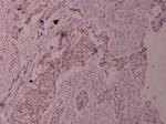 Phospho-TPL2 (Thr290) Polyclonal Antibody