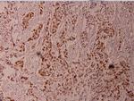 Phospho-ELK1 (Thr417) Polyclonal Antibody