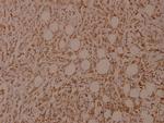 Phospho-Filamin A (Ser2152) Polyclonal Antibody
