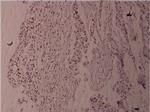 Phospho-Fyn (Tyr530) Polyclonal Antibody
