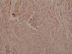 Phospho-GSK3 alpha/beta (Tyr279, Tyr216) Antibody in Immunohistochemistry (Paraffin) (IHC (P))
