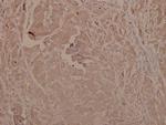 Phospho-GSK3 alpha/beta (Tyr279, Tyr216) Polyclonal Antibody
