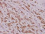 Phospho-HDAC8 (Ser39) Antibody in Immunohistochemistry (Paraffin) (IHC (P))