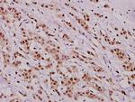 Phospho-HDAC8 (Ser39) Polyclonal Antibody