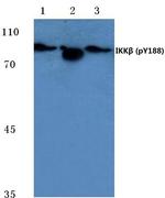 Phospho-IKK beta (Tyr188) Antibody in Western Blot (WB)