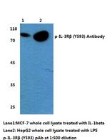 Phospho-CSF2RB (Tyr593) Polyclonal Antibody