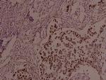 Phospho-JunB (Ser259) Antibody in Immunohistochemistry (Paraffin) (IHC (P))