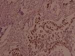 Phospho-JunB (Ser259) Polyclonal Antibody