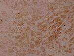 Phospho-Cytokeratin 18 (Ser33) Antibody in Immunohistochemistry (Paraffin) (IHC (P))