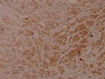 Phospho-Cytokeratin 18 (Ser33) Polyclonal Antibody