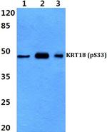 Phospho-Cytokeratin 18 (Ser33) Antibody in Western Blot (WB)