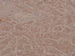 Phospho-MEF2A (Thr319) Antibody in Immunohistochemistry (Paraffin) (IHC (P))