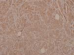Phospho-MEK3 (Ser189) Antibody in Immunohistochemistry (Paraffin) (IHC (P))
