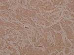 Phospho-MEK6 (Ser207) Polyclonal Antibody