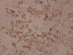 Phospho-c-Myc (Ser62) Polyclonal Antibody