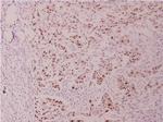 Phospho-c-Myc (Thr358) Polyclonal Antibody