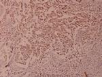 Phospho-NFkB p100 (Ser866) Polyclonal Antibody