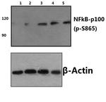 Phospho-NFkB p100 (Ser866) Antibody in Western Blot (WB)